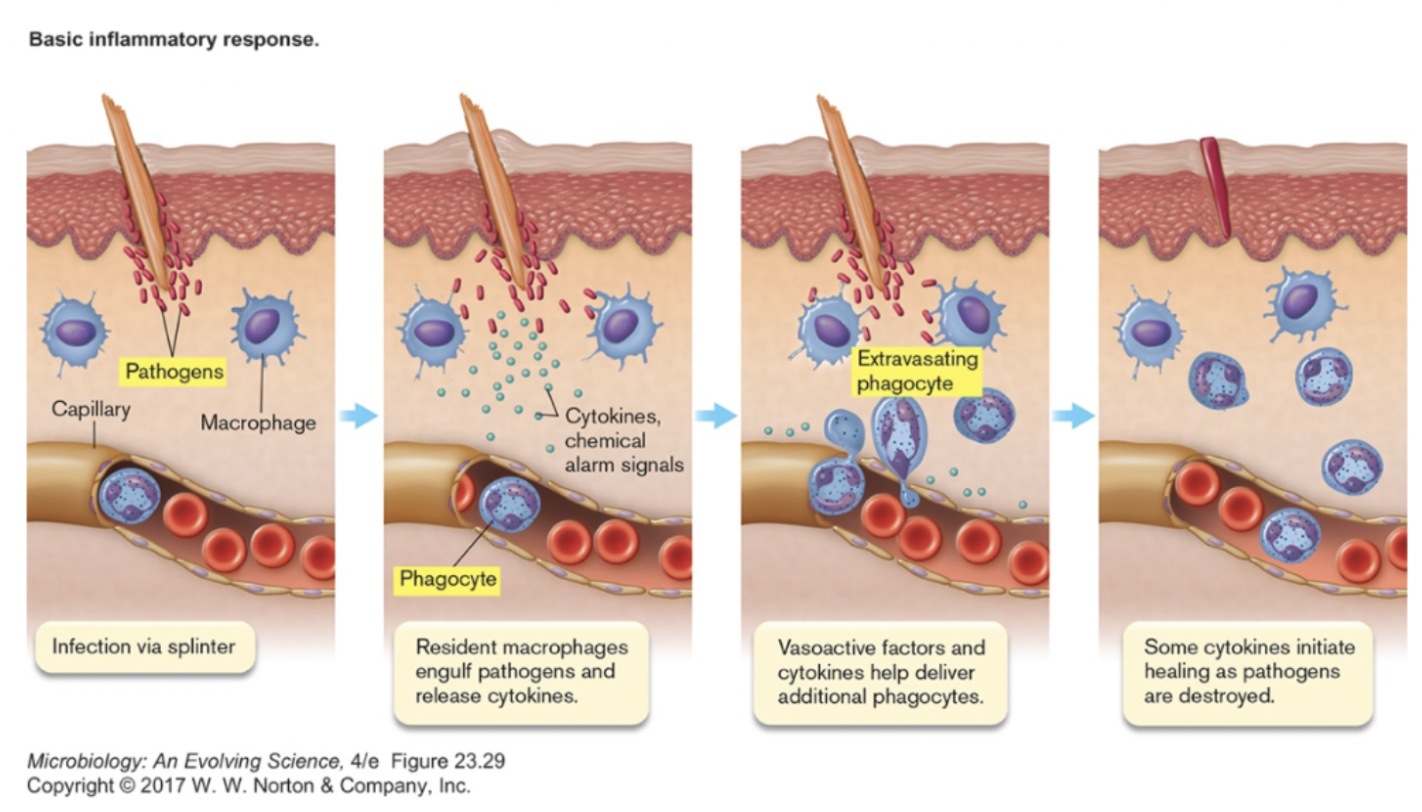 <p><strong>Inflammatory response process:</strong></p><p>Resident _______ engulf pathogens and release ______ (chemical alarm signals)</p><p>Vasoactive factors and [blank #2] help deliver additional phagocytes</p><p>Some [blank #2] initiate healing as pathogens are destroyed</p>