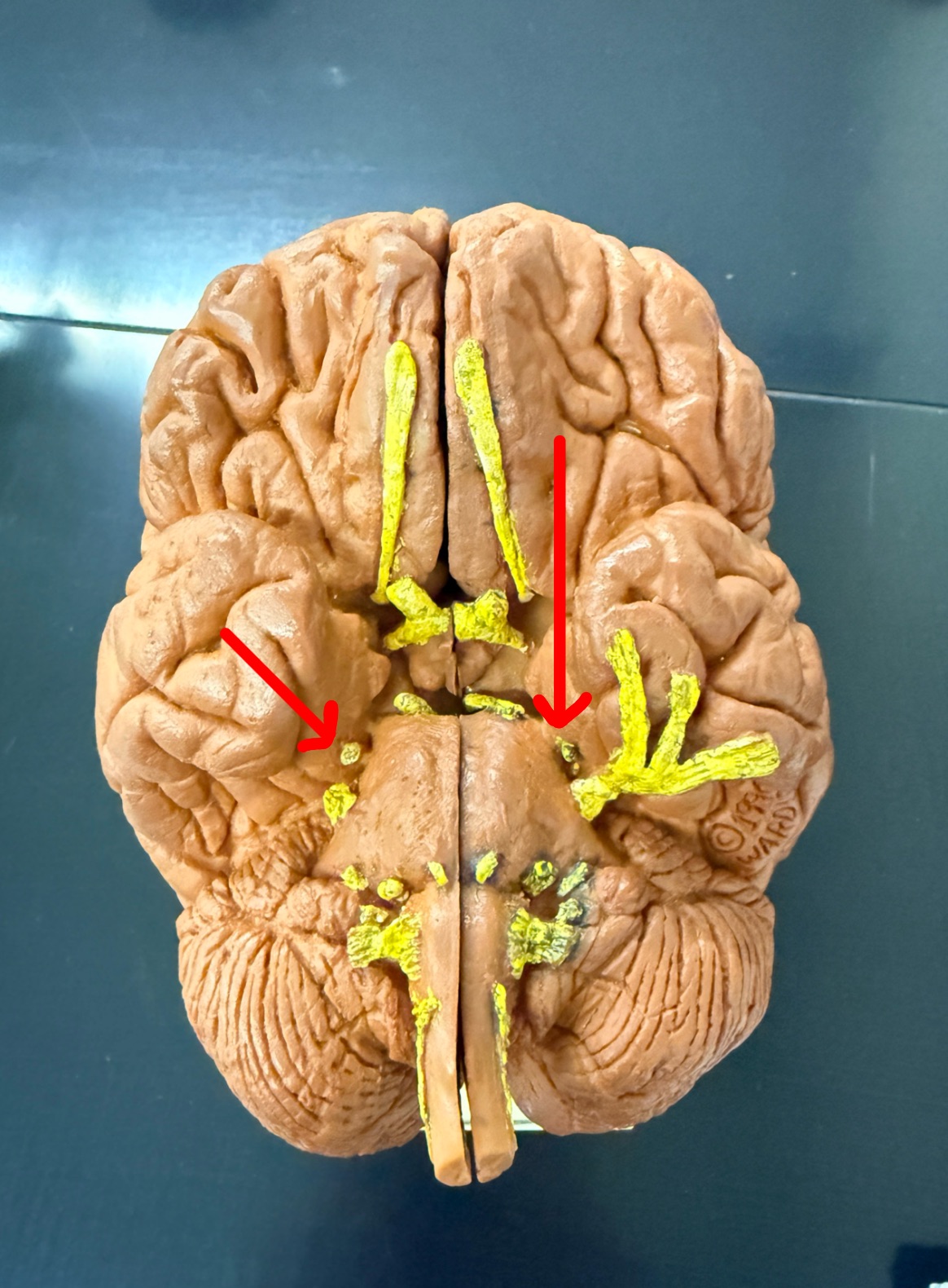 <p>Name the cranial nerve on the brain model</p>