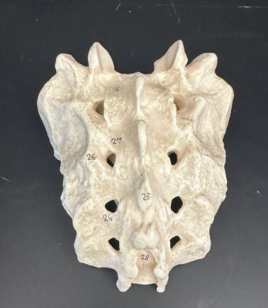 <p>What is this bone?</p>