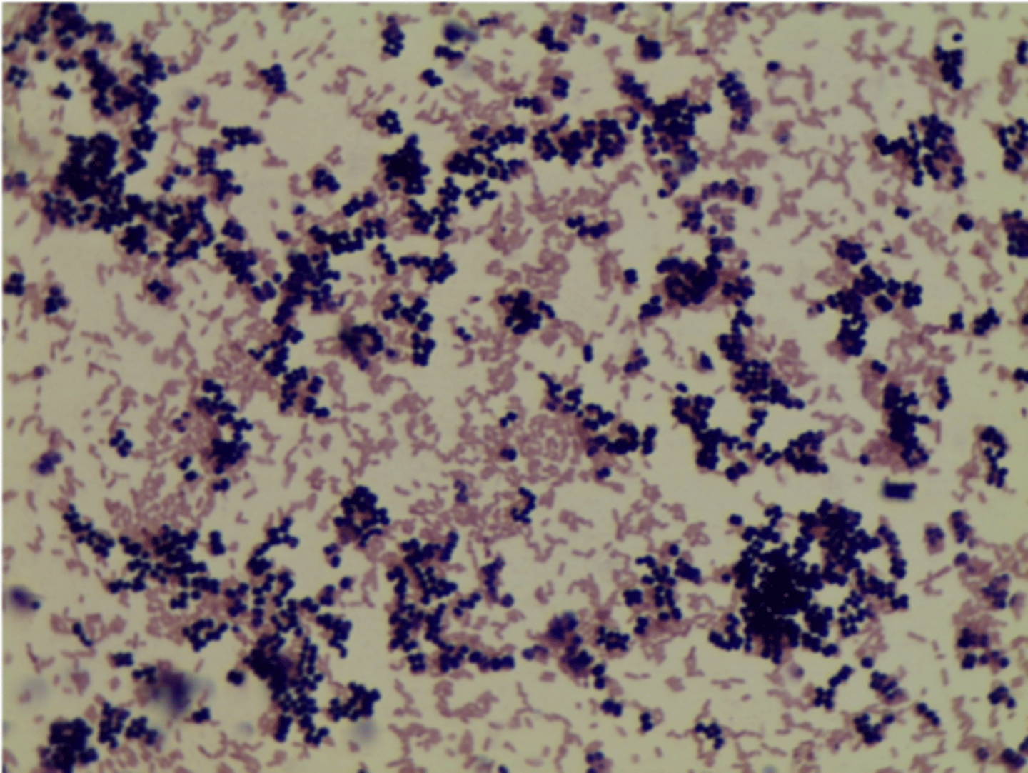 <p>-look for e. coli (pink) -- gram negative</p><p>-Bacillus- Gram positive; blue; bigger rods</p>