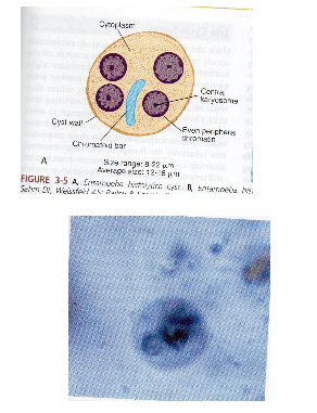 <p>What are key morphology features of Entamoeba histolytica cysts?</p>