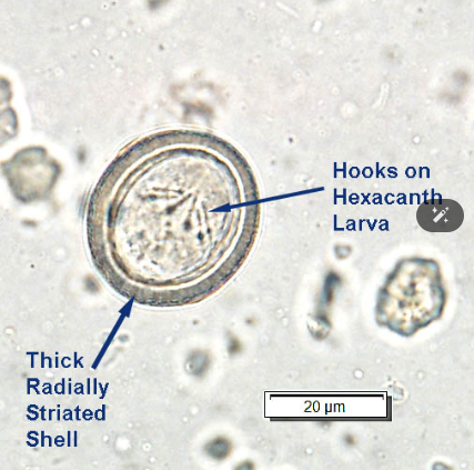 <p>describe the egg of taenia solium + taenia saginata. </p>