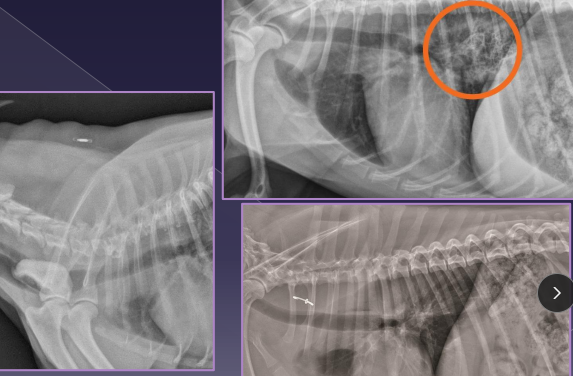 <p><span>Esophageal Foreign Body</span></p>