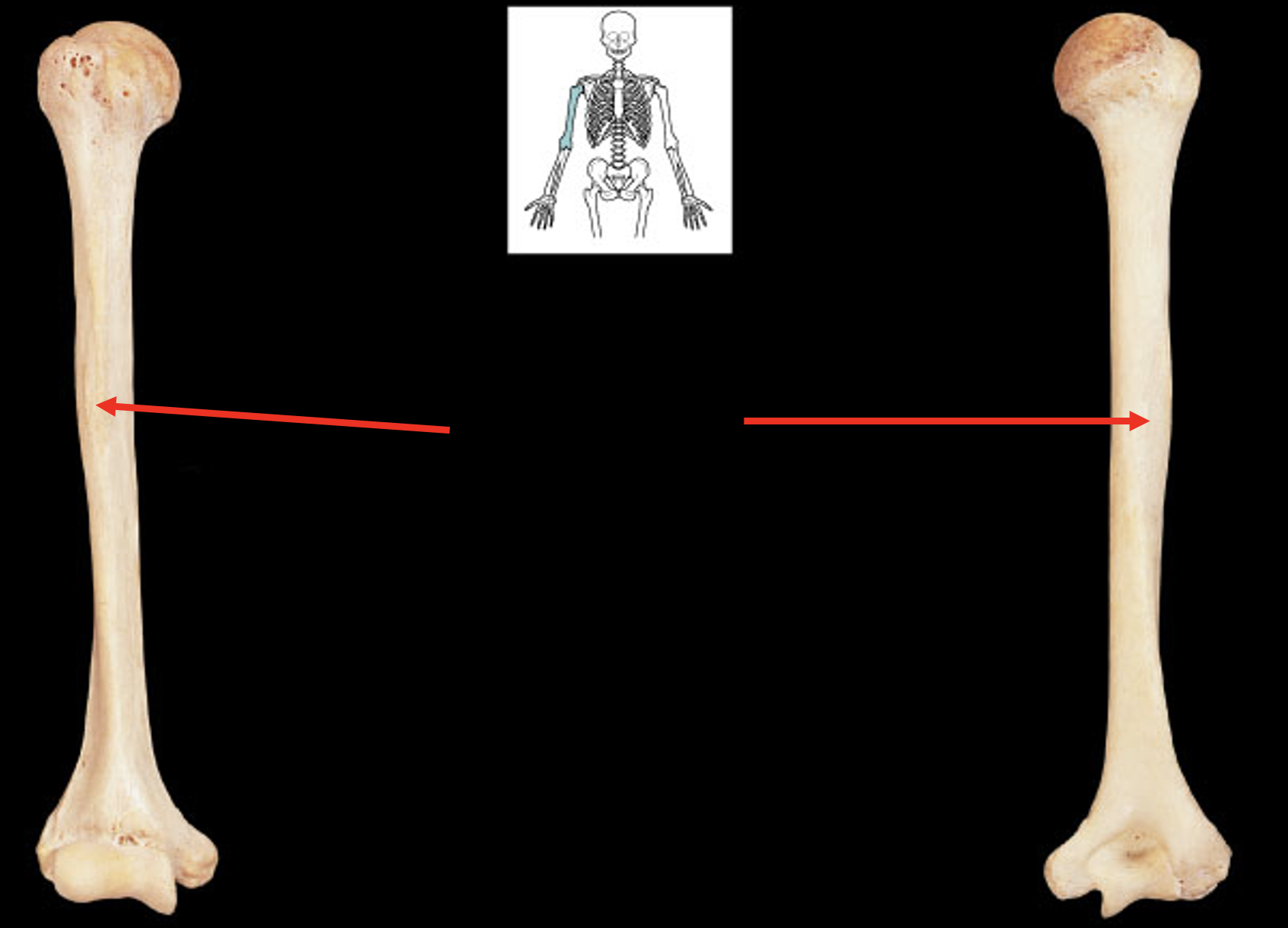 <p>Name this region of the humerus</p>