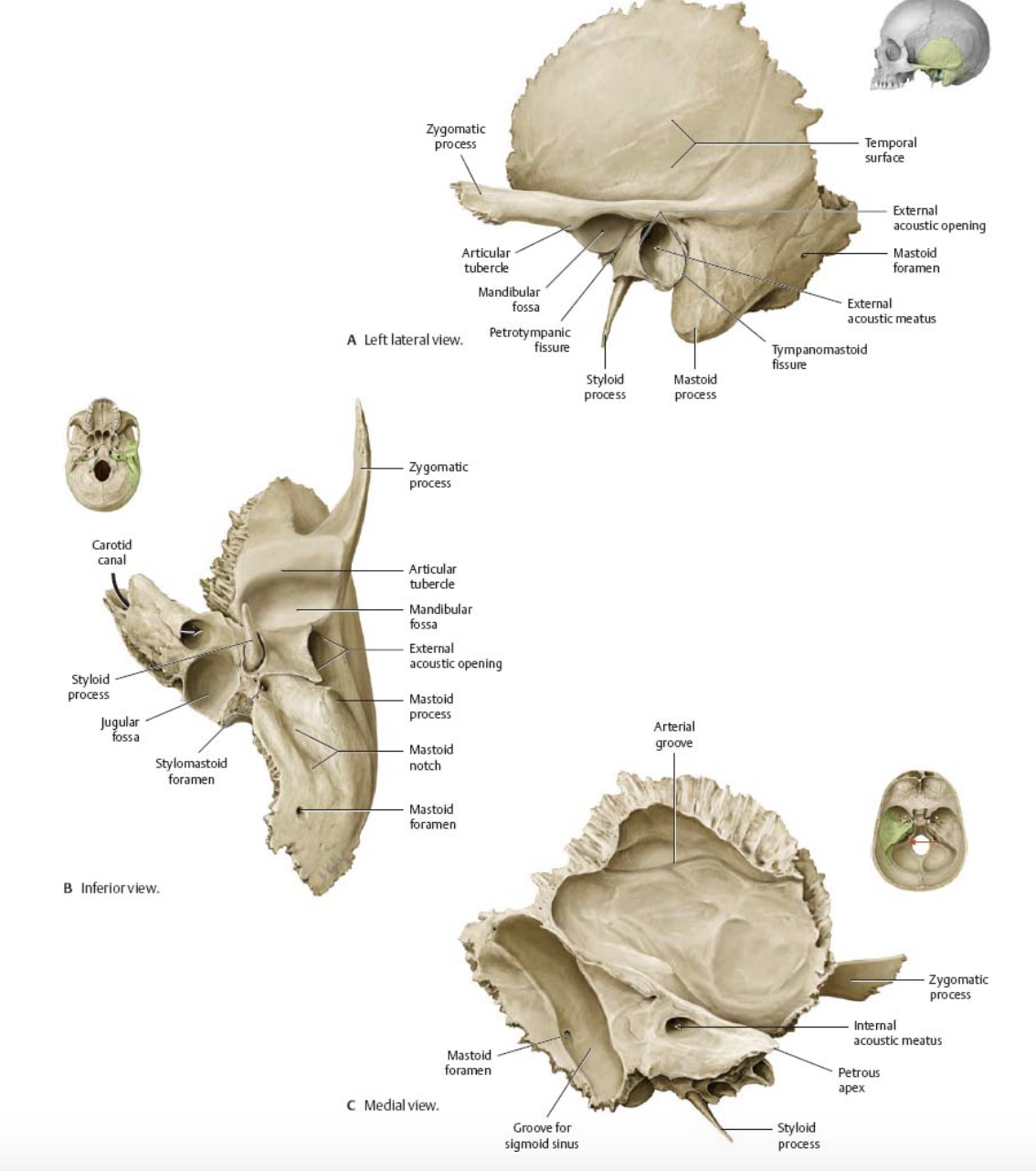 <ul><li><p>Forms the inferolateral aspects of the skull and contribute to the middle cranial fossa</p></li><li><p>Each has squamous, tympanic and petrous parts </p></li></ul><p></p>