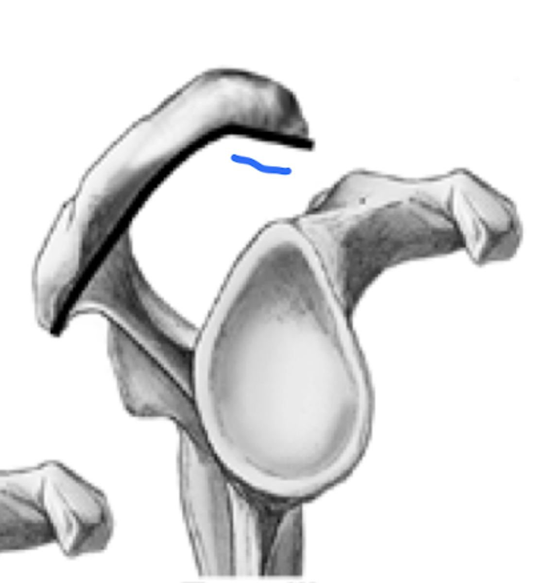 <p>most implicated in RTC tears</p>