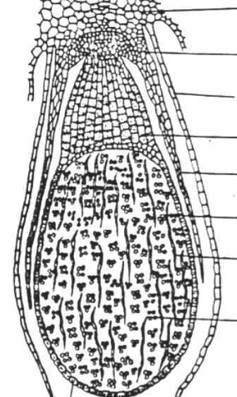 <p>Vad kollar du på, och från vilket fylum? Vad är funktionen av det du kollar på? Peka ut sporangium, sporer, elaster, seta och calyptra</p>
