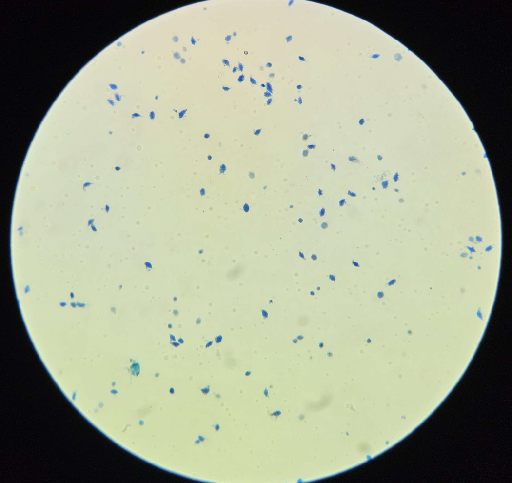 <p><span data-name="microscope" data-type="emoji">🔬</span><span data-name="petri_dish" data-type="emoji">🧫</span><strong><span> </span>Na podstawie zdjęcia preparatu:</strong></p><p></p><ul><li><p><span data-name="book" data-type="emoji">📖</span><span> </span>rozpoznaj gatunek pasożyta;</p></li></ul><p></p><ul><li><p><span data-name="recycle" data-type="emoji">♻</span><span> </span>rozpoznaj wszystkie formy rozwojowe;</p></li></ul><p></p><ul><li><p><span data-name="microbe" data-type="emoji">🦠</span><span> </span>wskaż organelle i cechy charakterystyczne dla danego gatunku;</p></li></ul><p></p><ul><li><p><span data-name="mask" data-type="emoji">😷</span><span> </span>nazwij chorobę, którą pasożyt wywołuje.</p></li></ul><p></p>