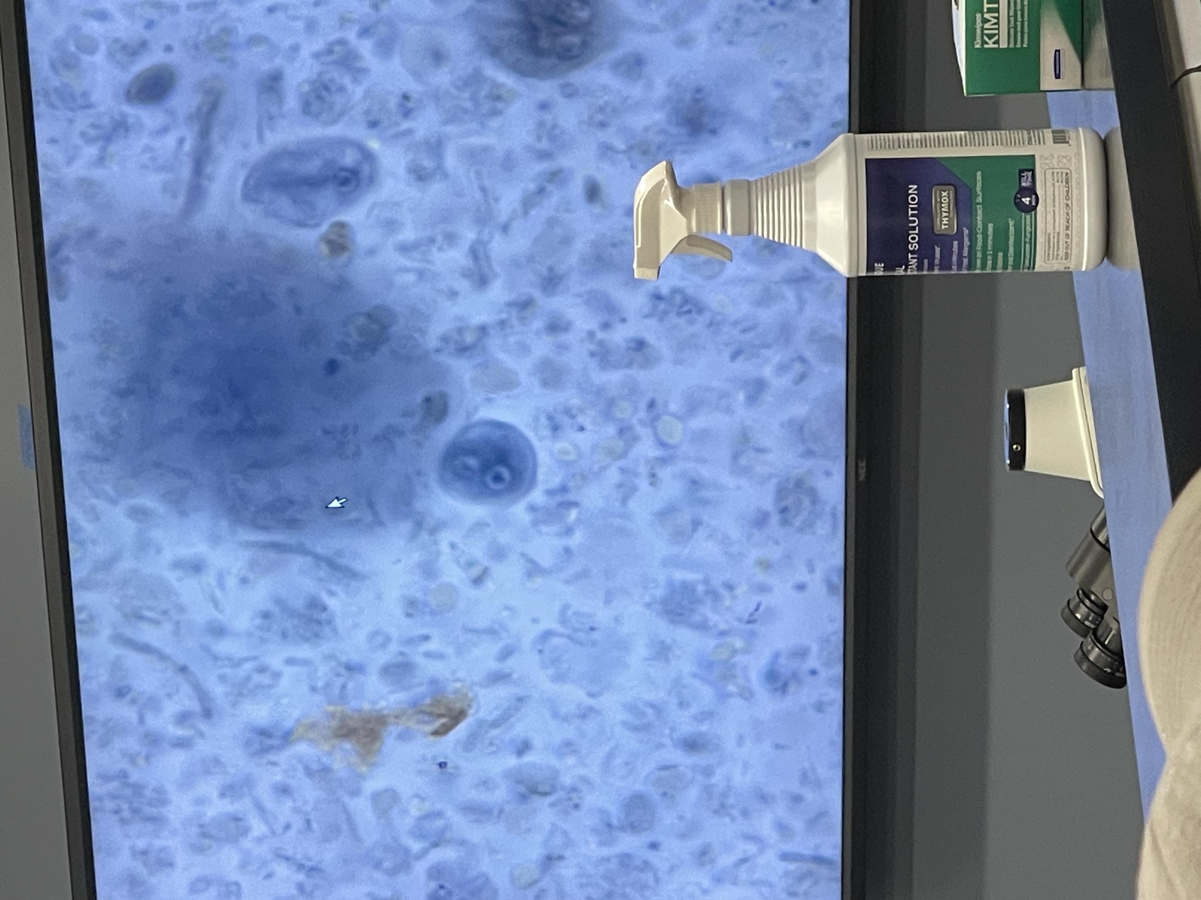 <ul><li><p>anaerobic </p></li><li><p>flagellated protist </p></li><li><p>causes giardiasis</p></li><li><p>major causes of diarrheal </p></li><li><p>comes from contaminated water</p></li><li><p>trophozoite (growing stage)</p></li></ul>