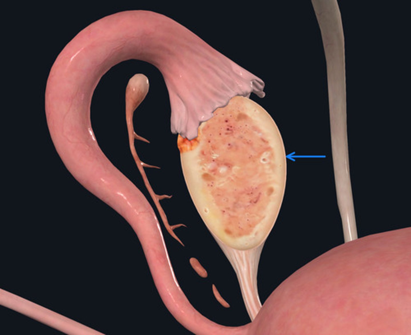 <p>ID Membrane marked by the Blue Arrow</p>