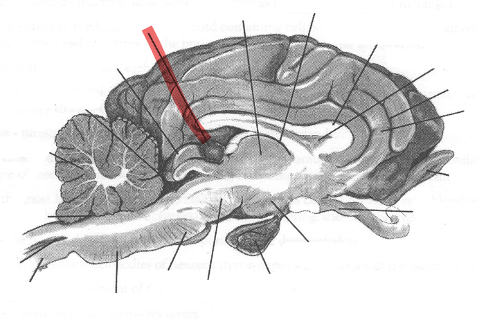 <p>Identify highlighted arrow</p>