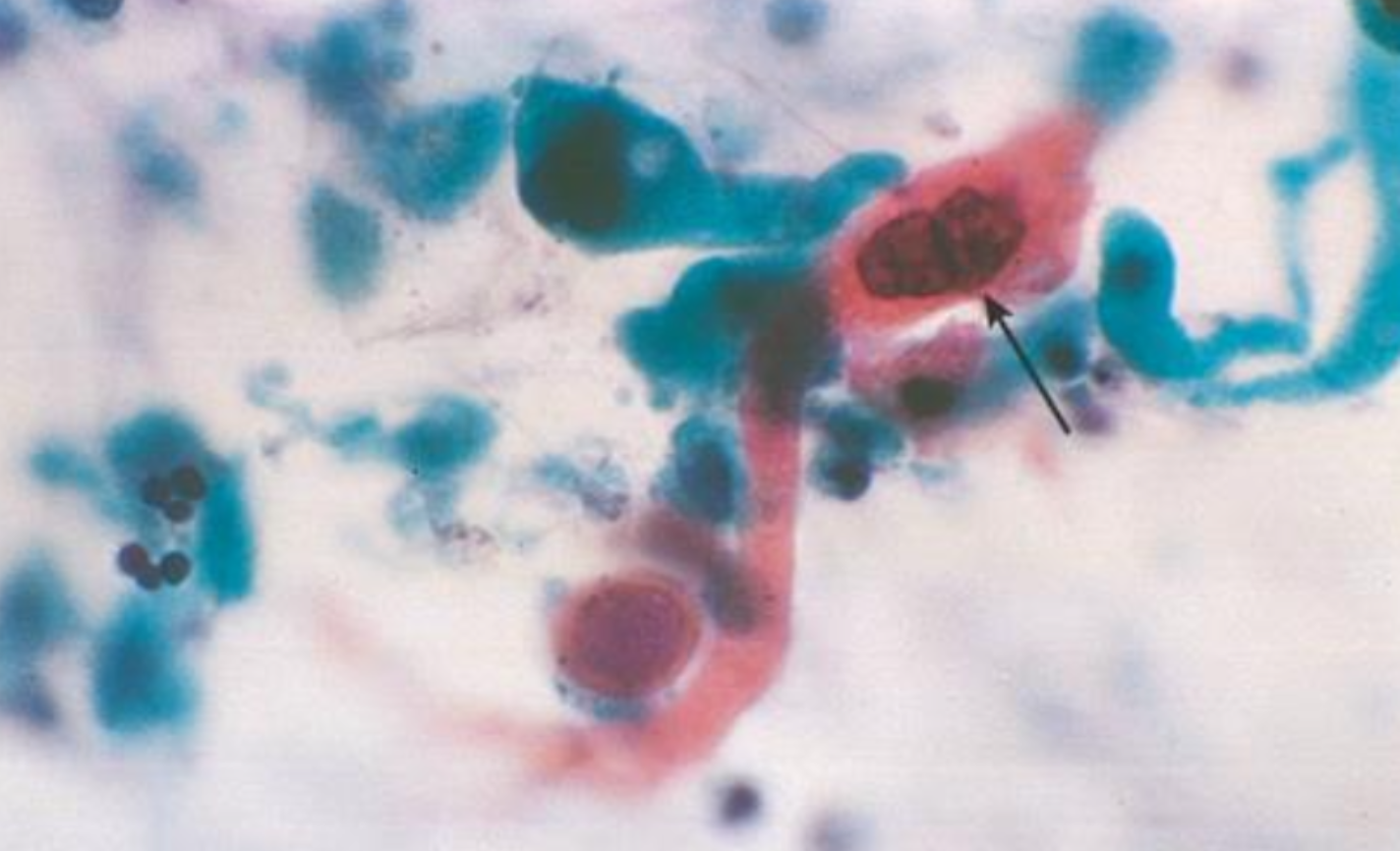 <p>Citología pulmonar</p>