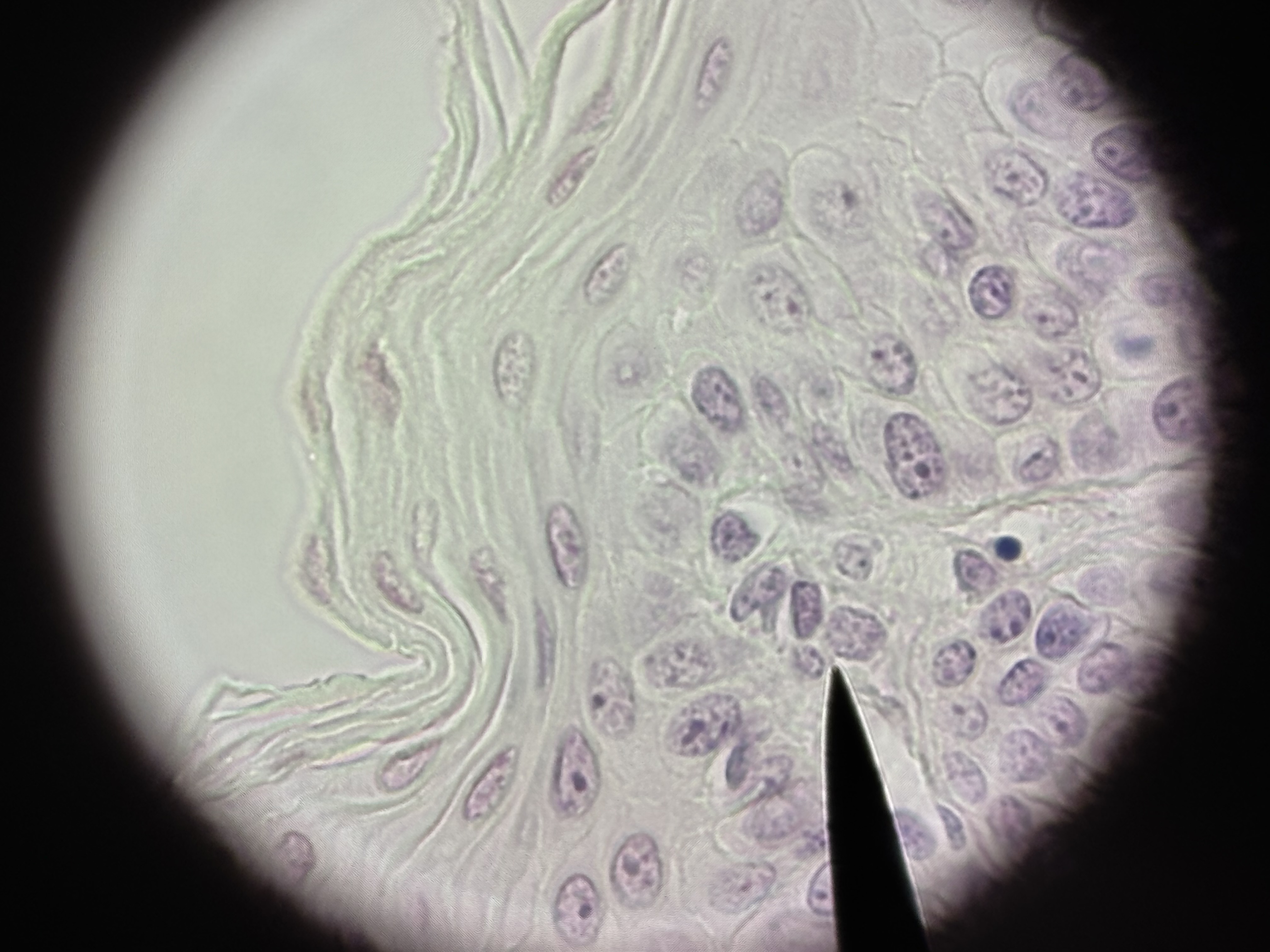 <p><span>Non-keratinized Stratified Squamous ET</span></p>