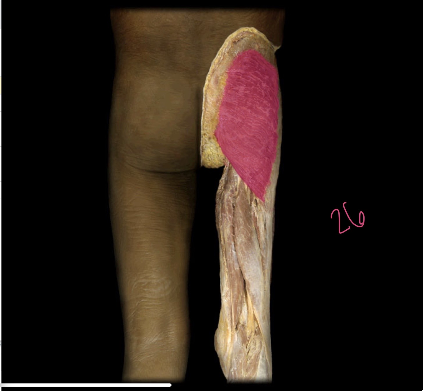 <p>Gluteus Maximus</p>