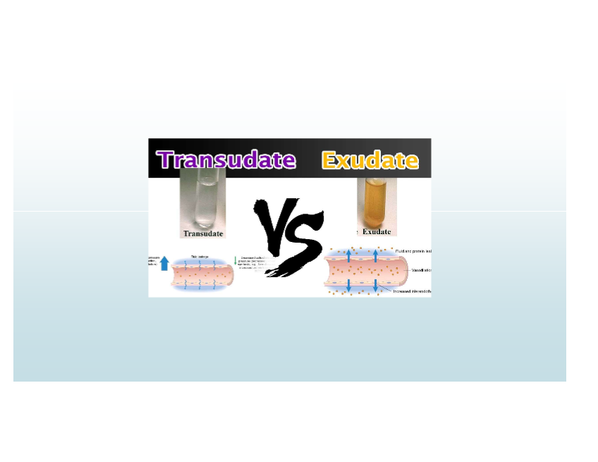 <p>Low-protein fluid; caused by osmotic/hydrostatic imbalance; non-inflammatory</p>