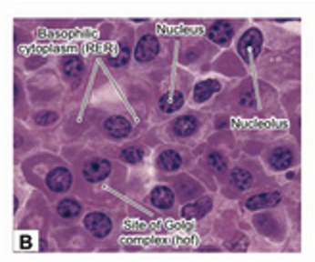 <p><span>The appearance of plasma cells in light microscopy is consistent with the ultrastructure of these antibody-secreting cells. The nucleus has a mixture of heterochromatin and euchromatin in an arrangement that is variously described as a "clock face" or checkerboard pattern. A large nucleolus or two occupy the center of the nucleus. The cytoplasm is basophilic as a result of the ribonucleic acid associated with the extensive RER. Depending upon the orientation of the cell in the section, a pale area, called the hof, can be seen adjacent to the nucleus. This unstained area is the location of the Golgi complex.</span></p>
