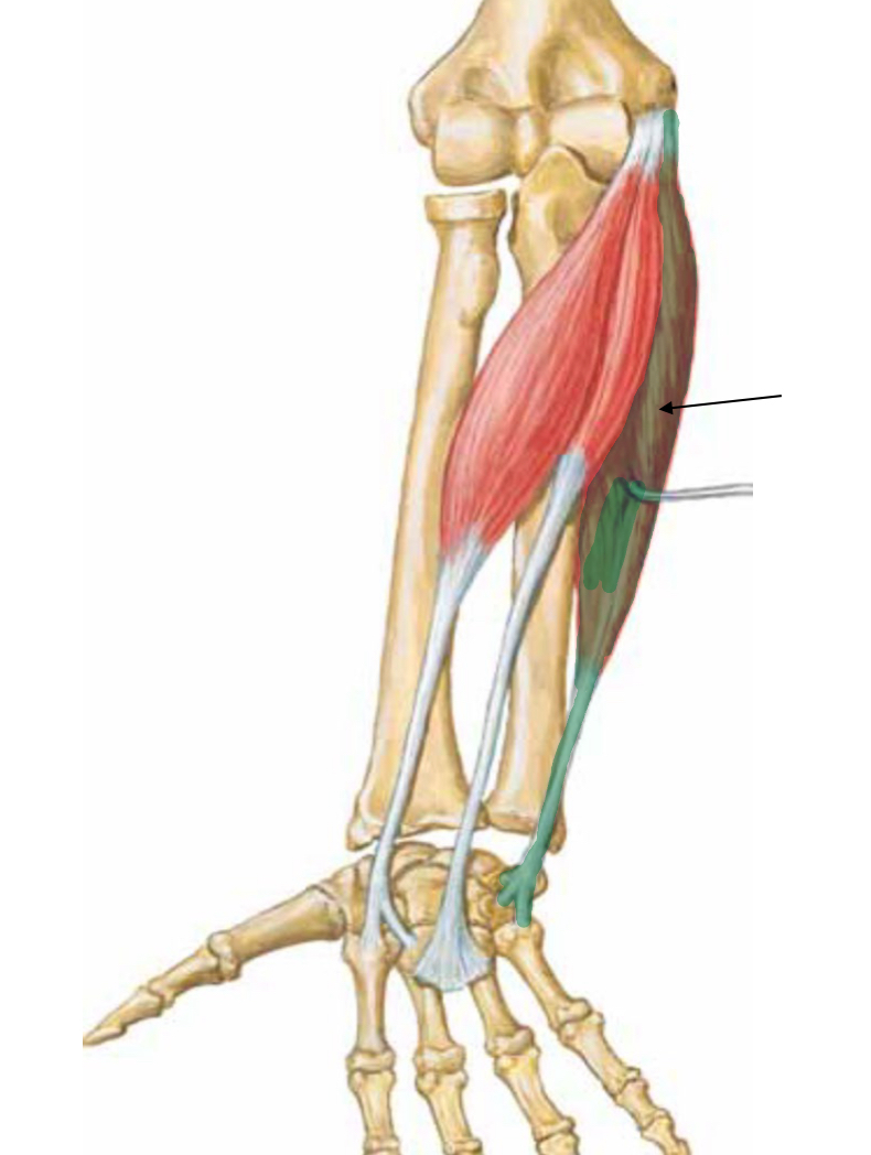 <p>What muscle is indicated?</p>