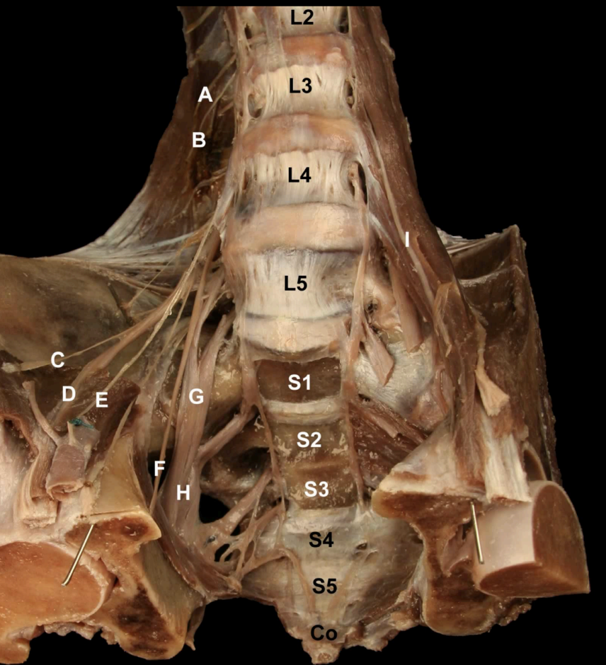 <p>Try and Identify the nerves and nerve roots of he <strong>Lumbarsacral Plexus&nbsp;</strong></p>