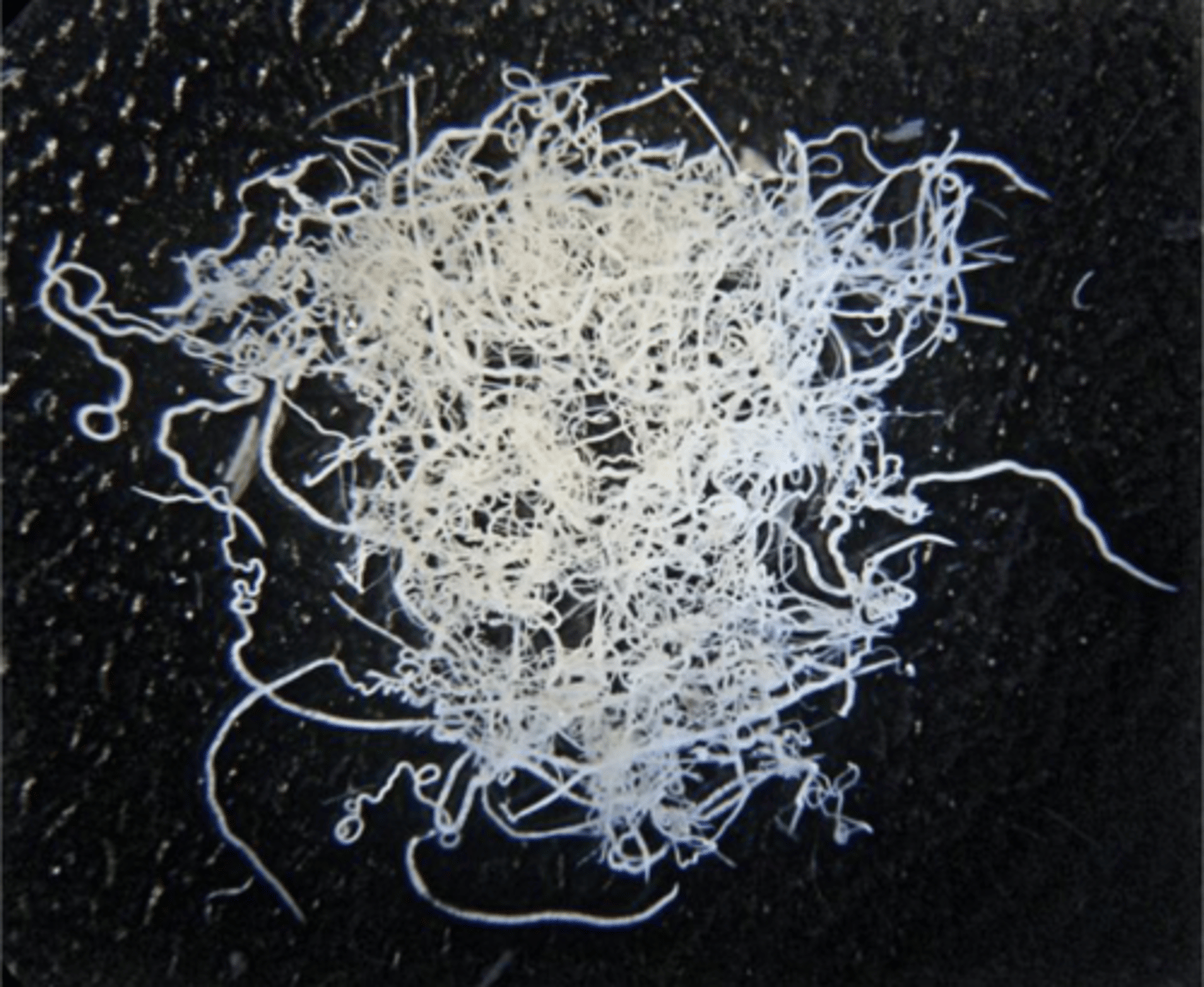 <p>What is this parasite? What characteristic/s did you use to identify it?</p>