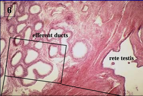 <p>Higher magnification of the <strong>rete testis</strong> (right side, lined by low cuboidal epithelium) and the <strong>efferent ducts of the epididymis </strong>(left).</p>