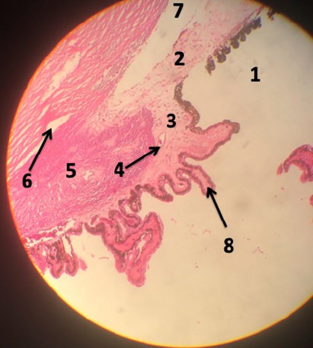 <p>#3</p>