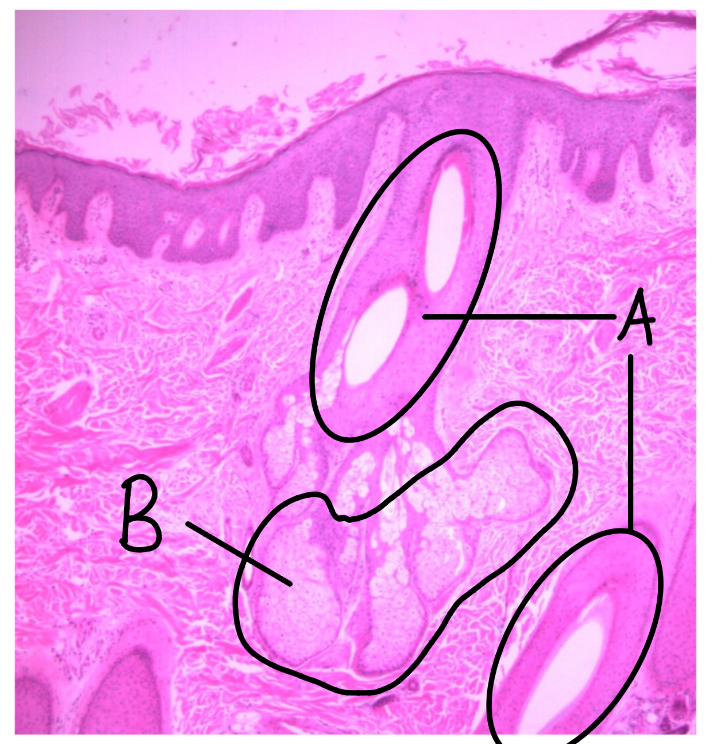 <p>Thin skin</p><ul><li><p>from scalp</p></li></ul><p></p><p>A: hair follicle</p><p>B: sebaceous glands</p><ul><li><p>secrete sebum (oily substance) </p></li></ul><p></p>