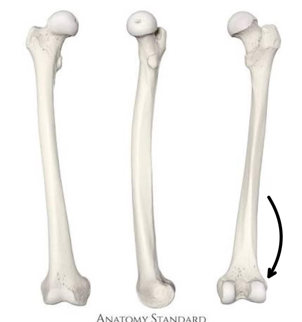 <p>what part of the femur is this?</p>