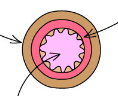 What type of blood vessel is shown in this picture?

Please state your reasoning