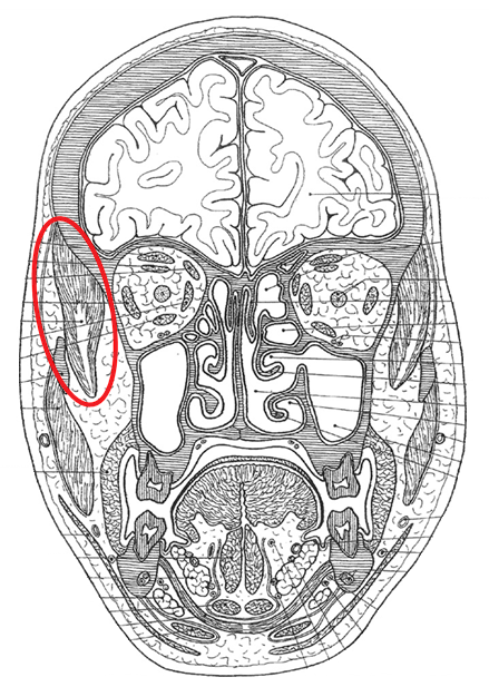 term image