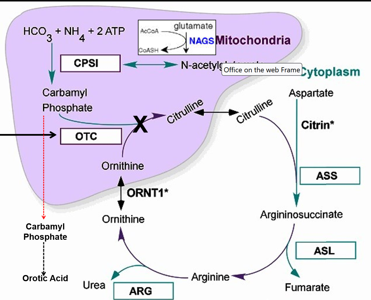 <p>Ornithine Transcarbamylase (OTC) Deficiency </p>
