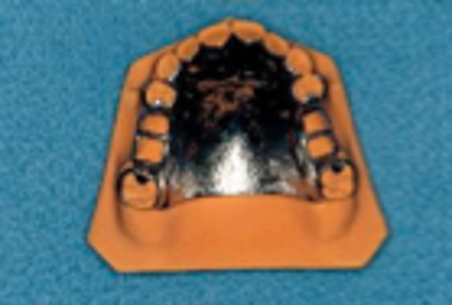 <p>indicated for maximum tissue support. Use in long distal extension cases or if anterior teeth are anticipated to be lost.</p><p>Indicated if the primary abutments are periodontally involved, or in cases with a shallow palatal vault or flabby tissues.</p>