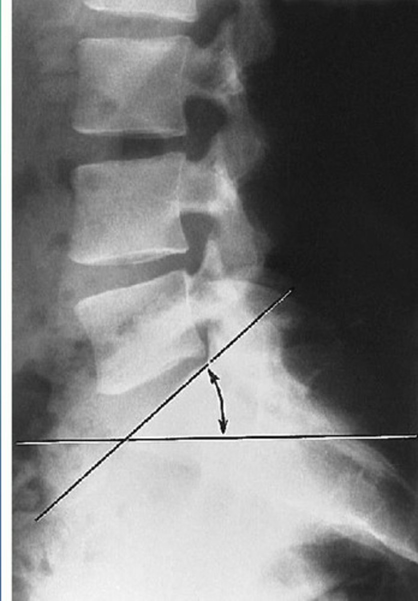 <p>What line of mensuration is this?</p>