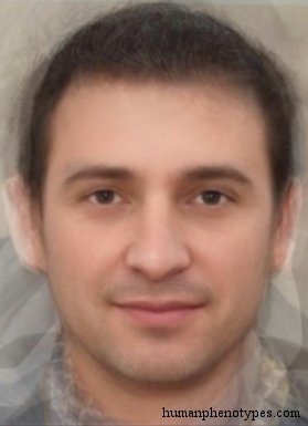 <p>Identify this Phenotype</p>