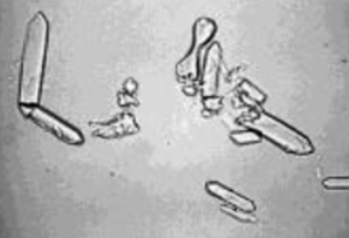 <p>- Shaped like barbells or picket fences</p><p>- Typically seen with antifreeze poisoning</p>