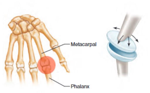 <ul><li><p> movement in 2 planes only + no rotation</p><ul><li><p>also known as ellipsoidal joint, the ovoid condyle of one bone fits into the elliptical cavity of another bone</p></li><li><p>example is the joint between metacarpals and phalanges</p></li></ul></li></ul><p></p>