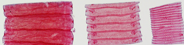 <p>What are these structures and what is their function? What Phylum and Class are these present in?</p>