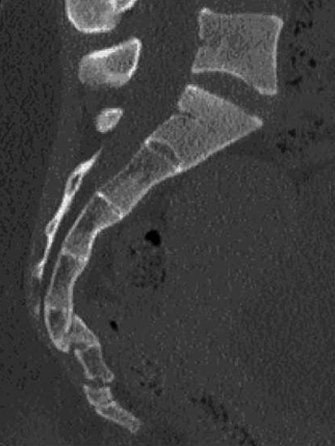 <p>Direct falls or impacts.</p>