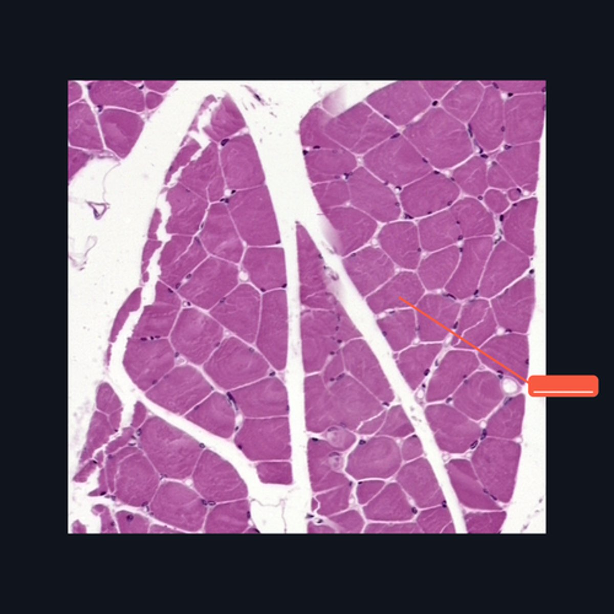 <p>Identify the structure</p>