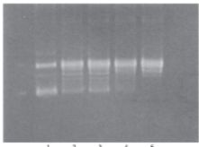 <p>as replication fork moves forward, positive supercoiling happens ahead of the fork</p><p>freshly replicated strands are becoming negatively supercoiled</p><p>torsional strain is relieved by topoisomerase:</p><ol><li><p>type I does not require ATP hydrolysis</p></li><li><p>type II requires ATP hydrolysis</p></li></ol><p>DNA relaxed by topoisomerase can be visualized on agarose gel → supercoiled DNA will move faster through the gel since it’s tightly packed</p>