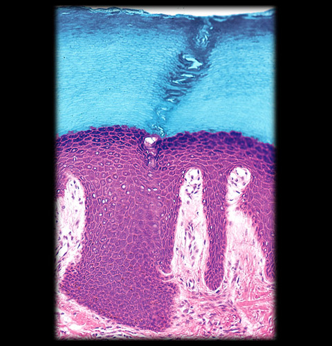 <p>What layer of the epidermis is highlighted</p>