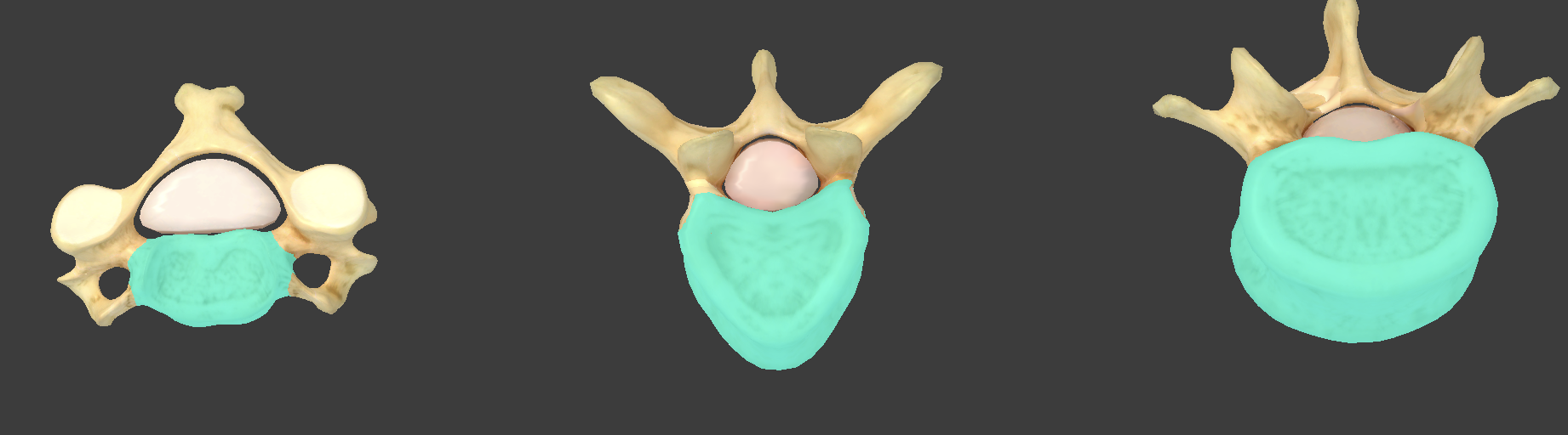 <p>what component of vertebrae is this?</p>