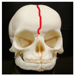 <p><span>Name the structure identified in red in the fetal skull.</span></p>