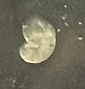 <p>This parasite was taken from the brain of an ant. What is it?</p>