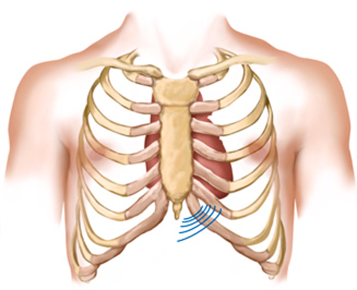 <p>A lift (heave) occurs with right ventricular hypertrophy, as found in pulmonic valve disease, pulmonic hypertension, and chronic lung disease.</p><p>diffuse lifting impulse during systole at the left lower sternal border</p><p>may be associated with retraction at the apex because the left ventricle is rotated posteriorly by the enlarged right ventricle.</p>