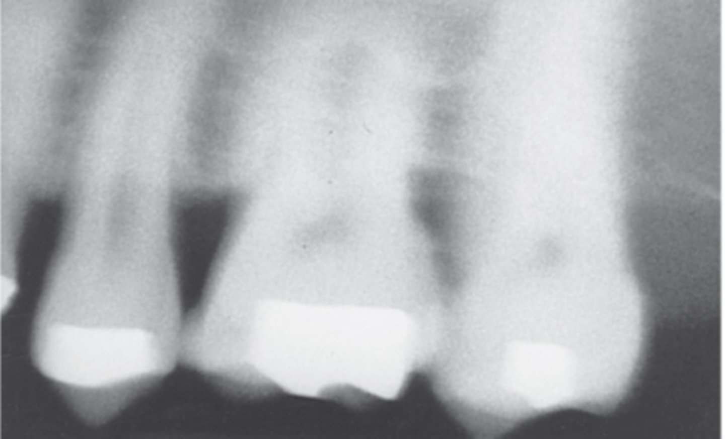 <p>Blurred images from patient or equipment movement.</p>