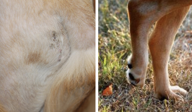 <p>malignant proliferation of histiocytic cells (interstitial DCs)</p>