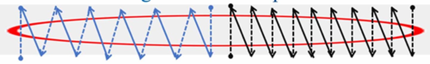 <p>Suture pattern on the right</p>
