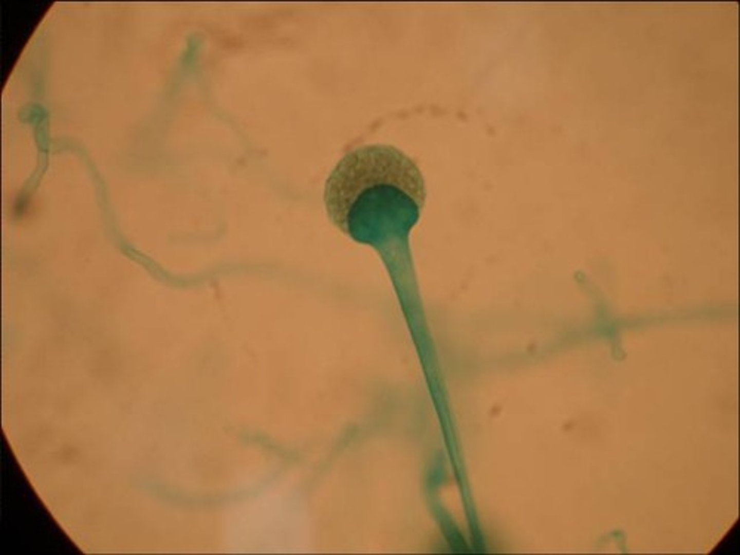 <p>Mucormycosis</p><p>Fungi - zygomycete (nonseptate hyphae), saphrophytic, asexual sporangiospores (zygospores), haploid nuclei</p><p>sporangium, “puffy ball”</p>