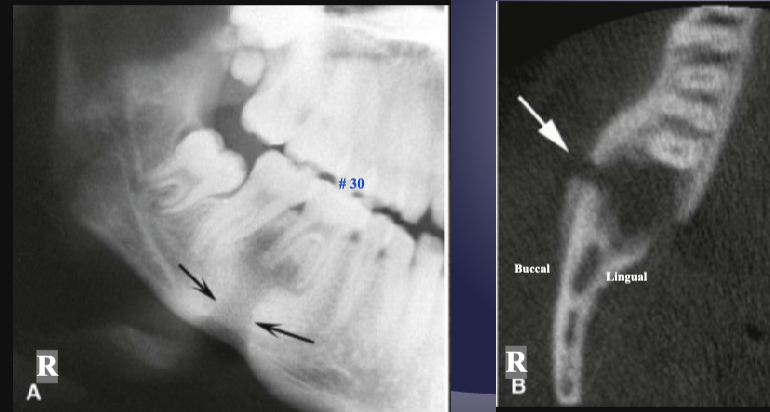 <p>what are the arrows pointing to </p>