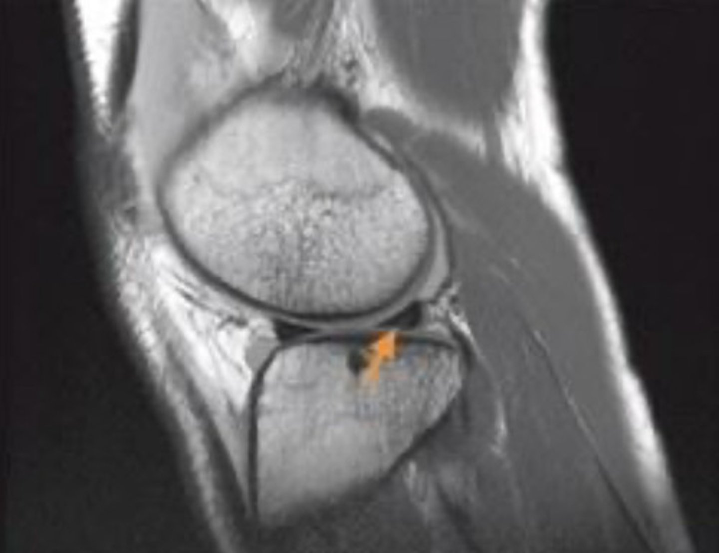 <p>sagittal view</p><p>2 multiple choice options</p>